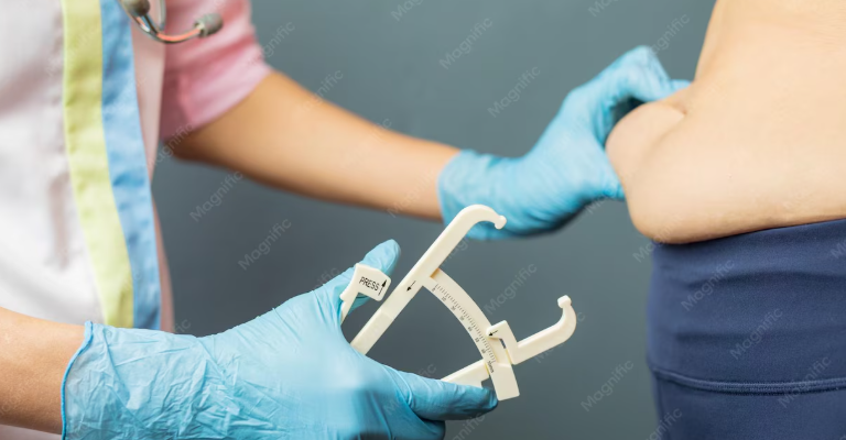 Bariatric Surgery